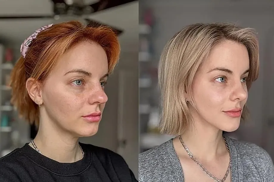 Warum Südkoreas Boom bei Anti-Aging-Behandlungen eine neue Welle von Medizintouristen anzieht