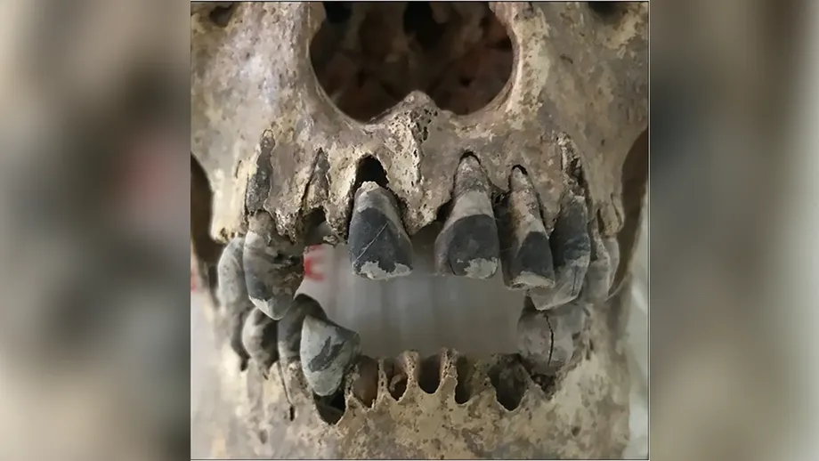 Geschwärzte Zähne im alten Vietnam: Wie Gemeinschaften der Eisenzeit einen 2.000 Jahre alten Schönheitsstandard schufen