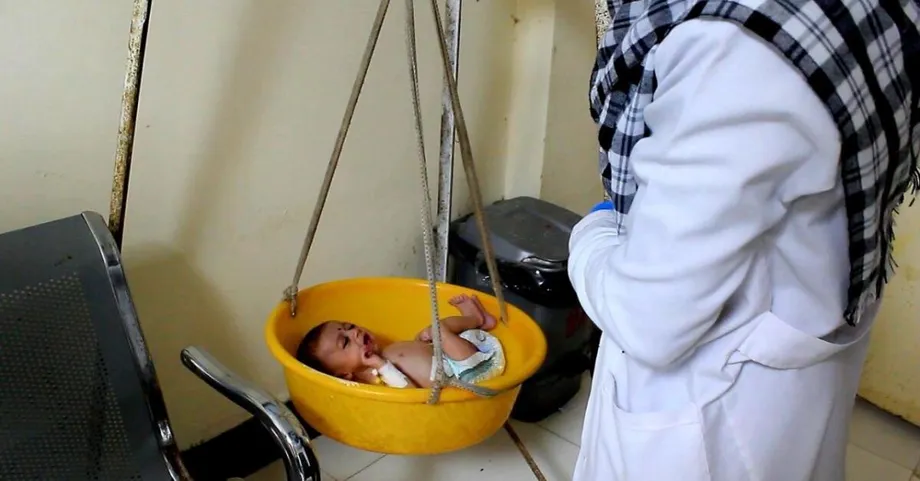Afghanistan Admitted 111,099 Children for Malnutrition Treatment in August as Aid Gaps Deepened